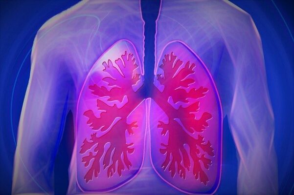 CBD Wirkung bei COPD