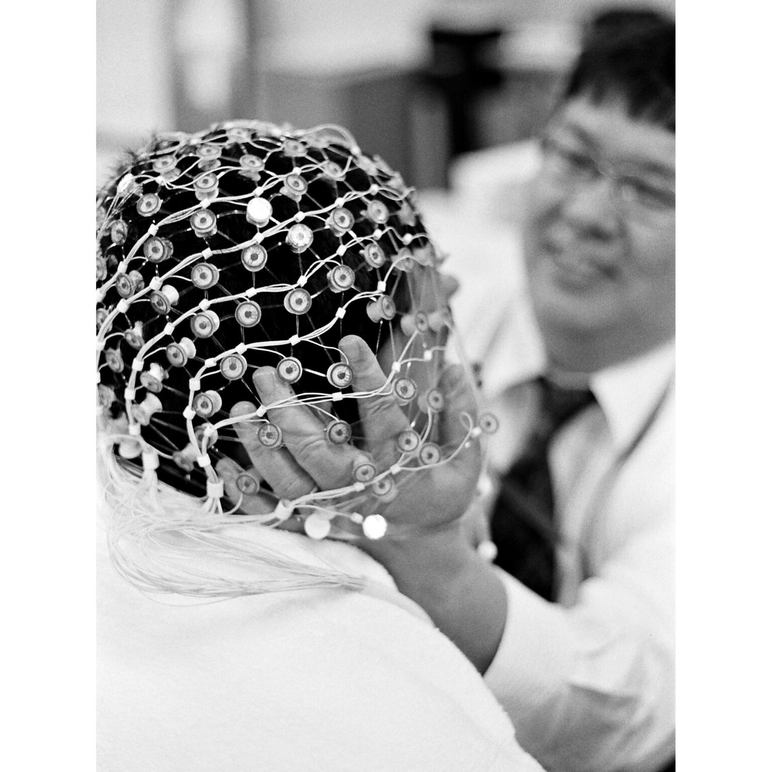 CBD Wirkung bei Epilepsie